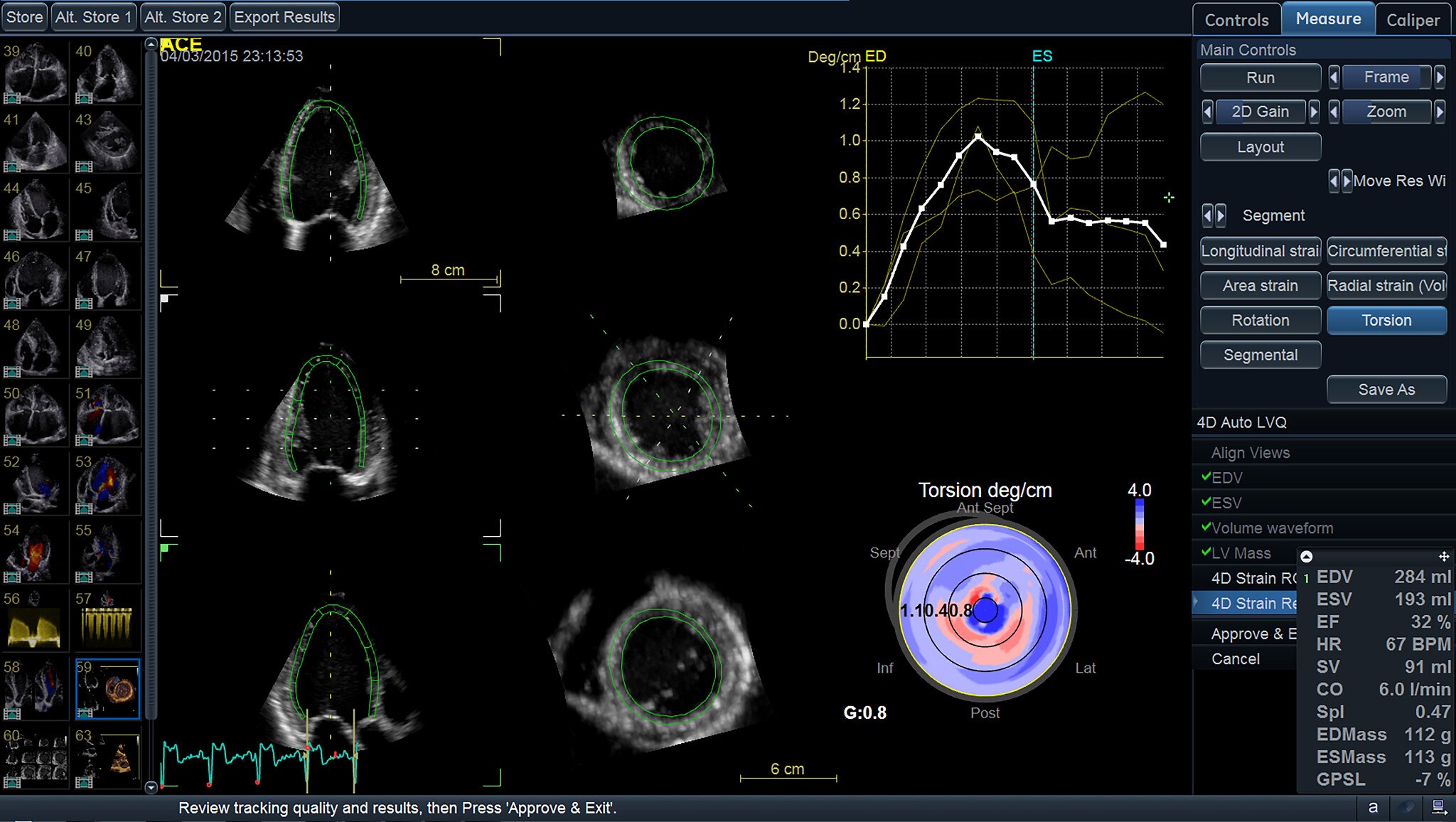 ViewPoint 6 and EchoPAC Suite for Cardiology - Ultrasound IT ...