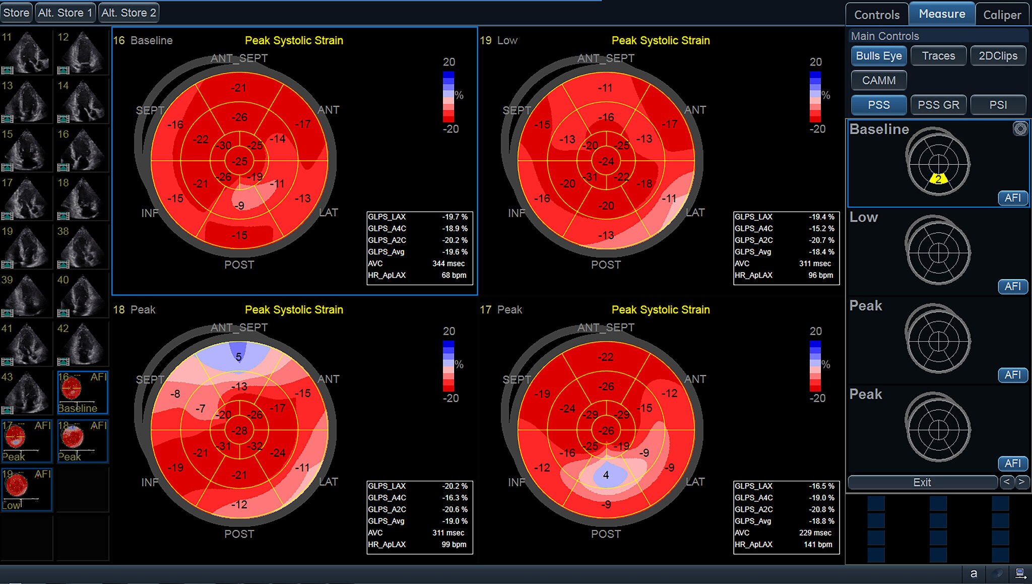 ViewPoint 6 and EchoPAC Suite for Cardiology - Ultrasound IT ...